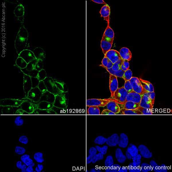 Immunocytochemistry/ Immunofluorescence - Anti-Caveolin-1 antibody [EPR15554] - N-terminal - Caveolae Marker (ab192869), expandable thumbnail