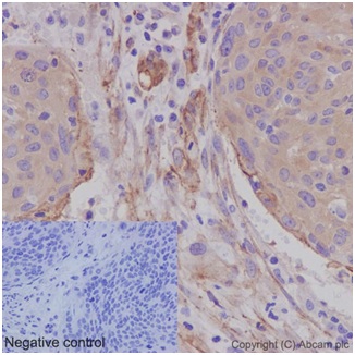 Immunohistochemistry (Formalin/PFA-fixed paraffin-embedded sections) - Anti-Caveolin-1 antibody [EPR15554] - N-terminal - Caveolae Marker (AB192869), expandable thumbnail