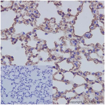 Immunohistochemistry (Formalin/PFA-fixed paraffin-embedded sections) - Anti-Caveolin-1 antibody [EPR15554] - N-terminal - Caveolae Marker (ab192869), expandable thumbnail