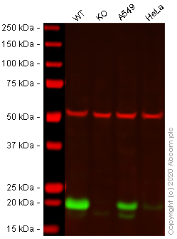 Western blot - Anti-Caveolin-1 antibody [EPR15554] - N-terminal - Caveolae Marker (AB192869), expandable thumbnail