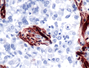 Immunohistochemistry (Formalin/PFA-fixed paraffin-embedded sections) - Anti-Caveolin-1 antibody - N-terminal - Caveolae Marker (AB231448), expandable thumbnail