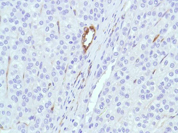 Immunohistochemistry (Formalin/PFA-fixed paraffin-embedded sections) - Anti-Caveolin-1 antibody [SP43] - BSA and Azide free (AB236437)