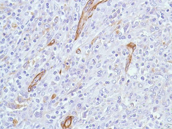 Immunohistochemistry (Formalin/PFA-fixed paraffin-embedded sections) - Anti-Caveolin-1 antibody [SP43] - BSA and Azide free (AB236437)
