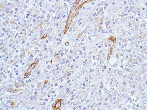 Immunohistochemistry (Formalin/PFA-fixed paraffin-embedded sections) - Anti-Caveolin-1 antibody [SP43] - BSA and Azide free (AB236437)