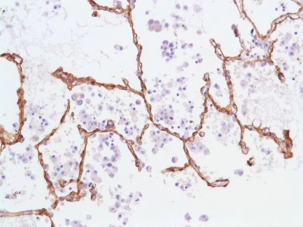 Immunohistochemistry (Formalin/PFA-fixed paraffin-embedded sections) - Anti-Caveolin-1 antibody [SP43] - BSA and Azide free (AB236437)