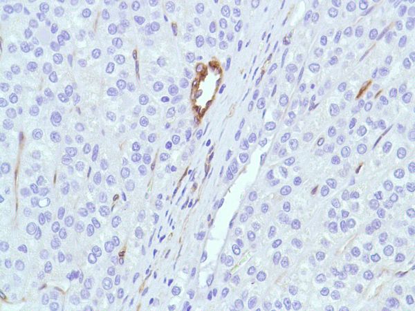 Immunohistochemistry (Formalin/PFA-fixed paraffin-embedded sections) - Anti-Caveolin-1 antibody [SP43] - C-terminal (AB227636), expandable thumbnail