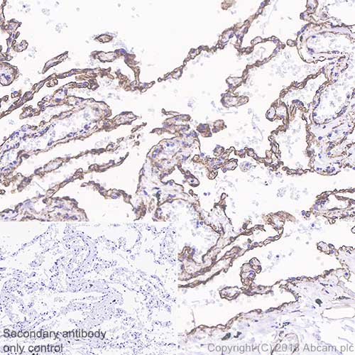 Immunohistochemistry (Formalin/PFA-fixed paraffin-embedded sections) - Anti-Caveolin-1 antibody [SP43] - C-terminal (AB227636), expandable thumbnail