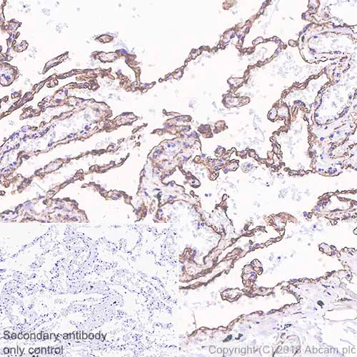 Immunohistochemistry (Formalin/PFA-fixed paraffin-embedded sections) - Anti-Caveolin-1 antibody [SP43] - C-terminal - Caveolae Marker (AB227636)