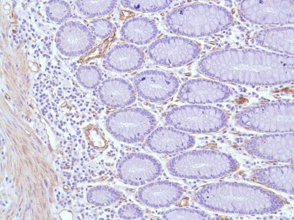 Immunohistochemistry (Formalin/PFA-fixed paraffin-embedded sections) - Anti-Caveolin-1 antibody [SP43] - C-terminal (ab227636), expandable thumbnail