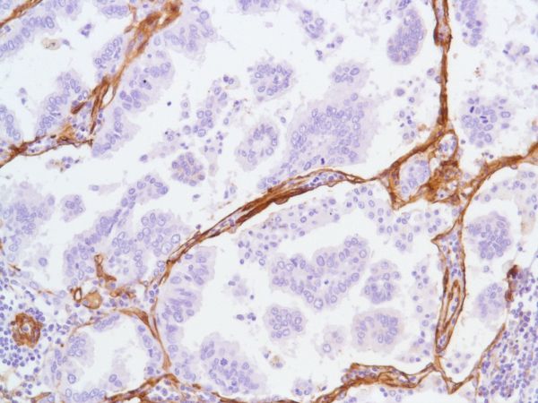 Immunohistochemistry (Formalin/PFA-fixed paraffin-embedded sections) - Anti-Caveolin-1 antibody [SP43] - C-terminal (AB227636), expandable thumbnail