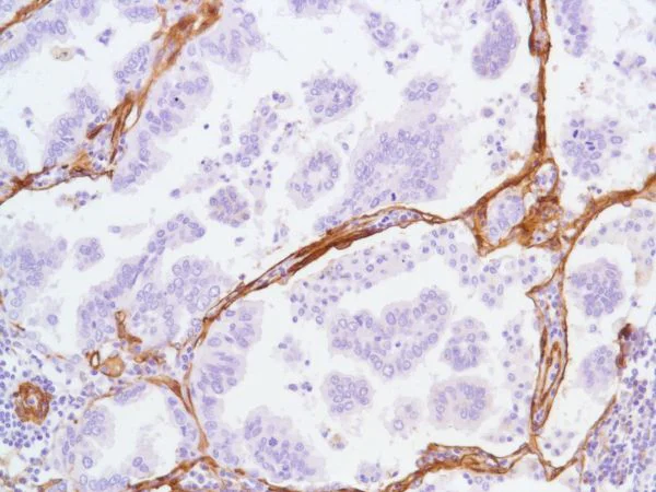 Immunohistochemistry (Formalin/PFA-fixed paraffin-embedded sections) - Anti-Caveolin-1 antibody [SP43] - C-terminal - Caveolae Marker (AB227636)