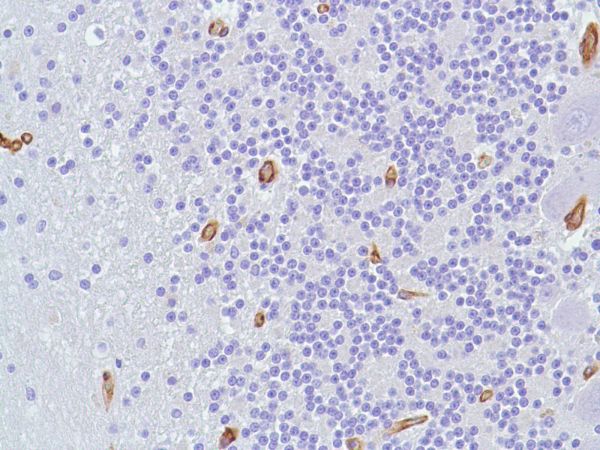 Immunohistochemistry (Formalin/PFA-fixed paraffin-embedded sections) - Anti-Caveolin-1 antibody [SP43] - C-terminal (ab227636), expandable thumbnail