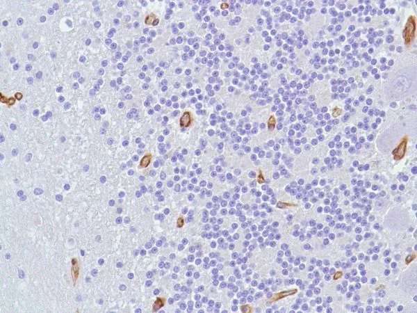 Immunohistochemistry (Formalin/PFA-fixed paraffin-embedded sections) - Anti-Caveolin-1 antibody [SP43] - C-terminal - Caveolae Marker (AB227636)