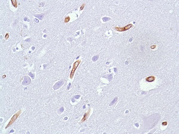 Immunohistochemistry (Formalin/PFA-fixed paraffin-embedded sections) - Anti-Caveolin-1 antibody [SP43] - C-terminal (ab227636), expandable thumbnail