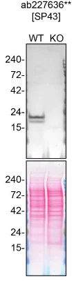 Western blot - Anti-Caveolin-1 antibody [SP43] - C-terminal - Caveolae Marker (AB227636)