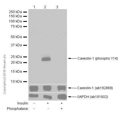 Western blot - Anti-Caveolin-1 (phospho Y14) antibody [EPR2288Y] (AB75876), expandable thumbnail