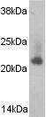 Western blot - Anti-Caveolin-2 antibody (AB2911)