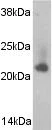 Western blot - Anti-Caveolin-2 antibody (AB2911)