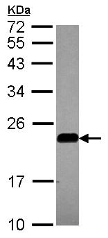 Western blot - Anti-Caveolin-2 antibody (AB97476)