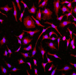 Immunocytochemistry/ Immunofluorescence - Anti-Caveolin-2 antibody [EPR2220] - Caveolae Marker (AB79397), expandable thumbnail