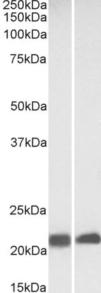 Western blot - Anti-Caveolin-3 antibody - Caveolae Marker (AB87770)