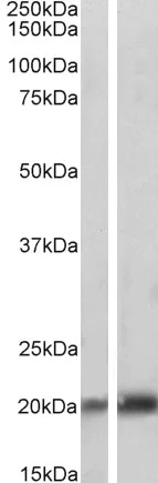 Western blot - Anti-Caveolin-3 antibody - Caveolae Marker (AB87770)