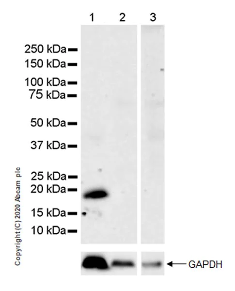 Western blot - Anti-Caveolin-3 antibody [EPR11082] - BSA and Azide free (AB249773)
