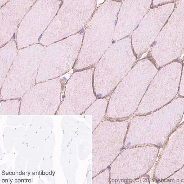 Immunohistochemistry (Formalin/PFA-fixed paraffin-embedded sections) - Anti-Caveolin-3 antibody [EPR11083] - BSA and Azide free (AB249654)