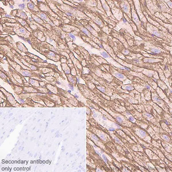 Immunohistochemistry (Formalin/PFA-fixed paraffin-embedded sections) - Anti-Caveolin-3 antibody [EPR11083] - BSA and Azide free (AB249654)