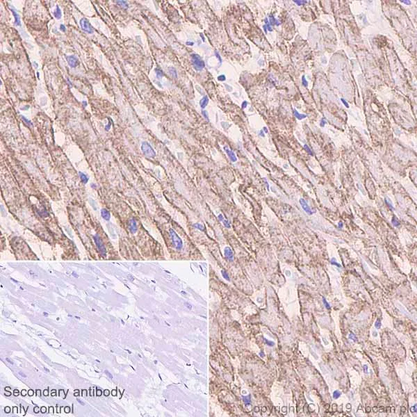 Immunohistochemistry (Formalin/PFA-fixed paraffin-embedded sections) - Anti-Caveolin-3 antibody [EPR11083] - BSA and Azide free (AB249654)