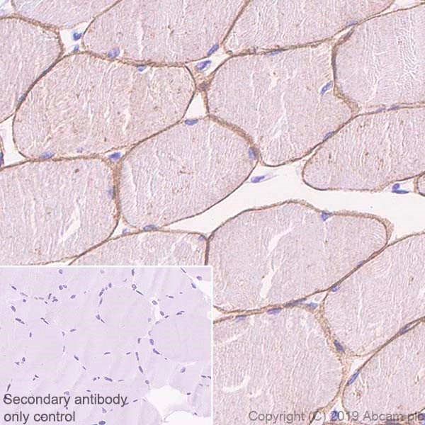 Immunohistochemistry (Formalin/PFA-fixed paraffin-embedded sections) - Anti-Caveolin-3 antibody [EPR11083] - BSA and Azide free (AB249654), expandable thumbnail