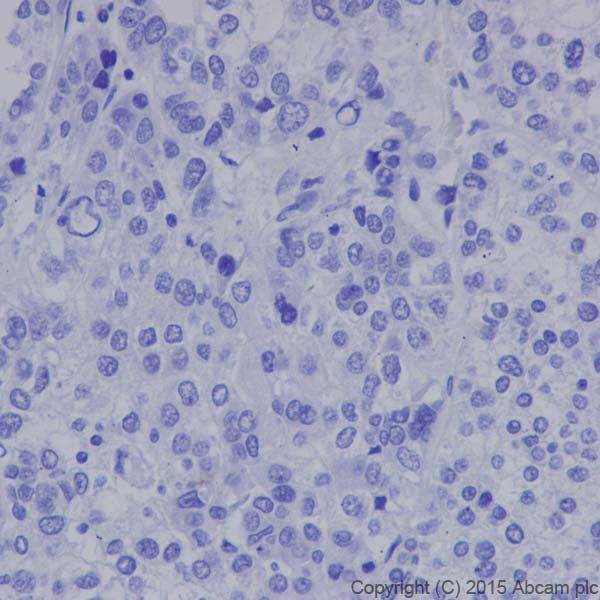Immunohistochemistry (Formalin/PFA-fixed paraffin-embedded sections) - Anti-Caveolin-3 antibody [EPR18975] - BSA and Azide free (ab250637), expandable thumbnail