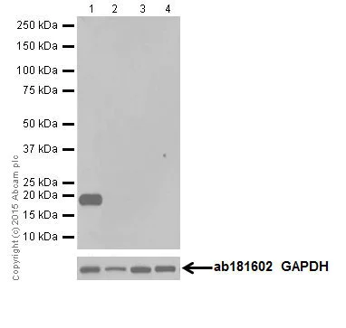 Western blot - Anti-Caveolin-3 antibody [EPR18975] - BSA and Azide free (AB250637)