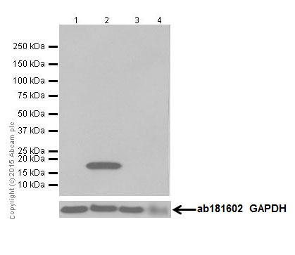 Western blot - Anti-Caveolin-3 antibody [EPR18975] - BSA and Azide free (AB250637), expandable thumbnail