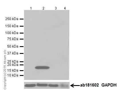 Western blot - Anti-Caveolin-3 antibody [EPR18975] - BSA and Azide free (AB250637)