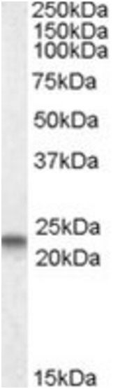 Western blot - Anti-Caveolin-3 antibody - N-terminal - Caveolae Marker (AB189349), expandable thumbnail