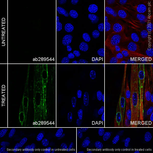 Immunocytochemistry/ Immunofluorescence - Anti-Caveolin-3 antibody [RM1042] - Caveolae Marker (AB289544)