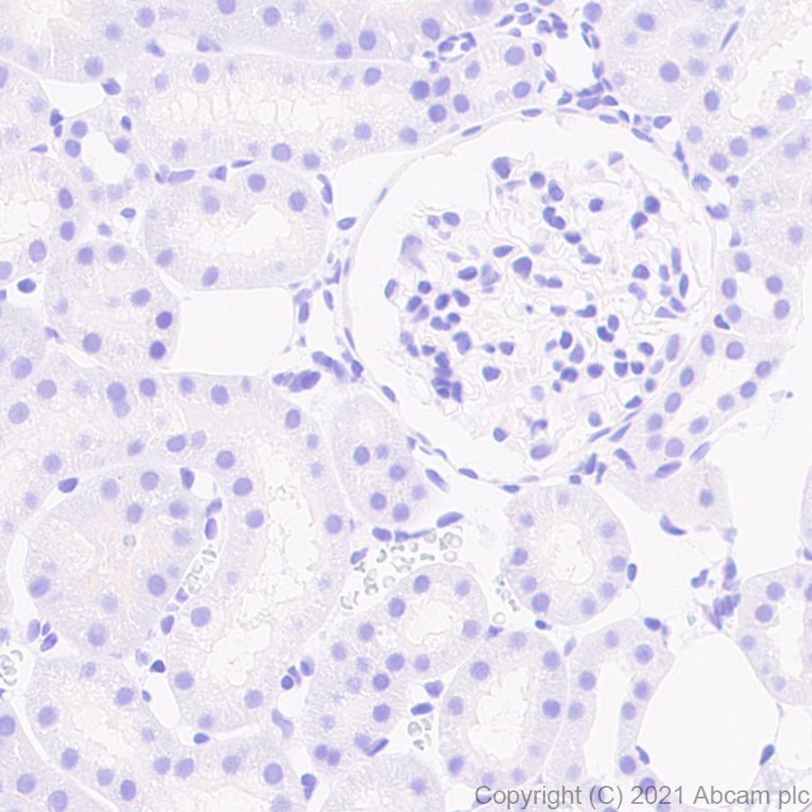 Immunohistochemistry (Formalin/PFA-fixed paraffin-embedded sections) - Anti-Caveolin-3 antibody [RM1042] (ab289544), expandable thumbnail