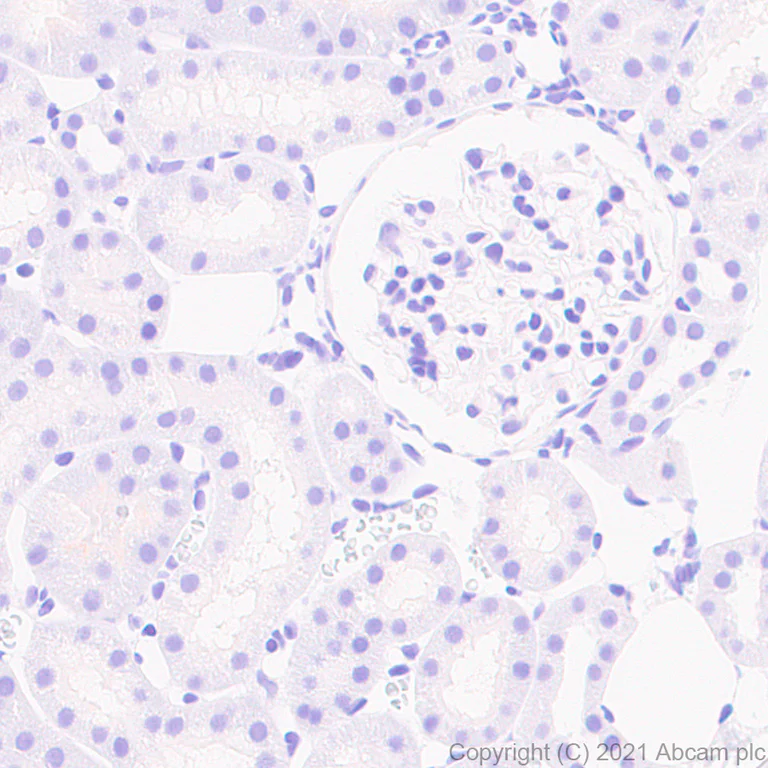 Immunohistochemistry (Formalin/PFA-fixed paraffin-embedded sections) - Anti-Caveolin-3 antibody [RM1042] - Caveolae Marker (AB289544)