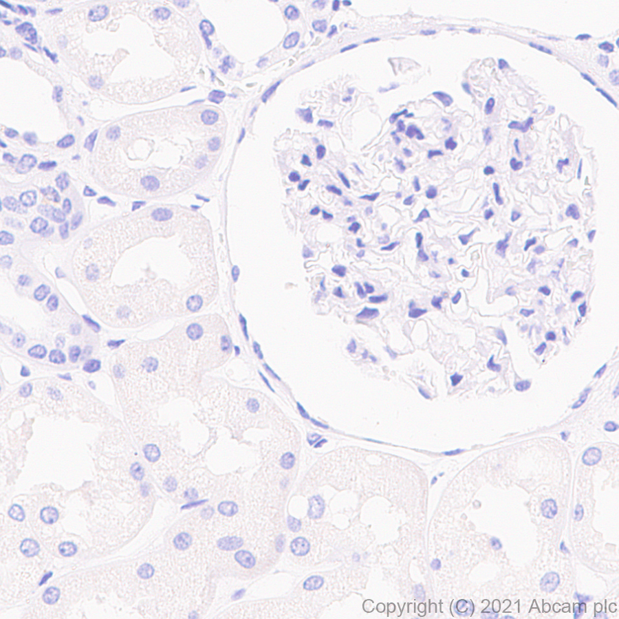 Immunohistochemistry (Formalin/PFA-fixed paraffin-embedded sections) - Anti-Caveolin-3 antibody [RM1042] (ab289544), expandable thumbnail