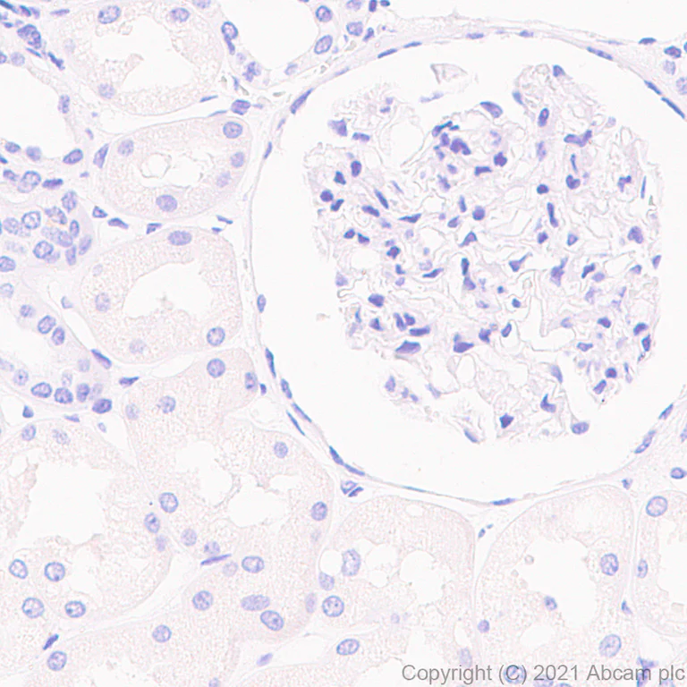 Immunohistochemistry (Formalin/PFA-fixed paraffin-embedded sections) - Anti-Caveolin-3 antibody [RM1042] - Caveolae Marker (AB289544)