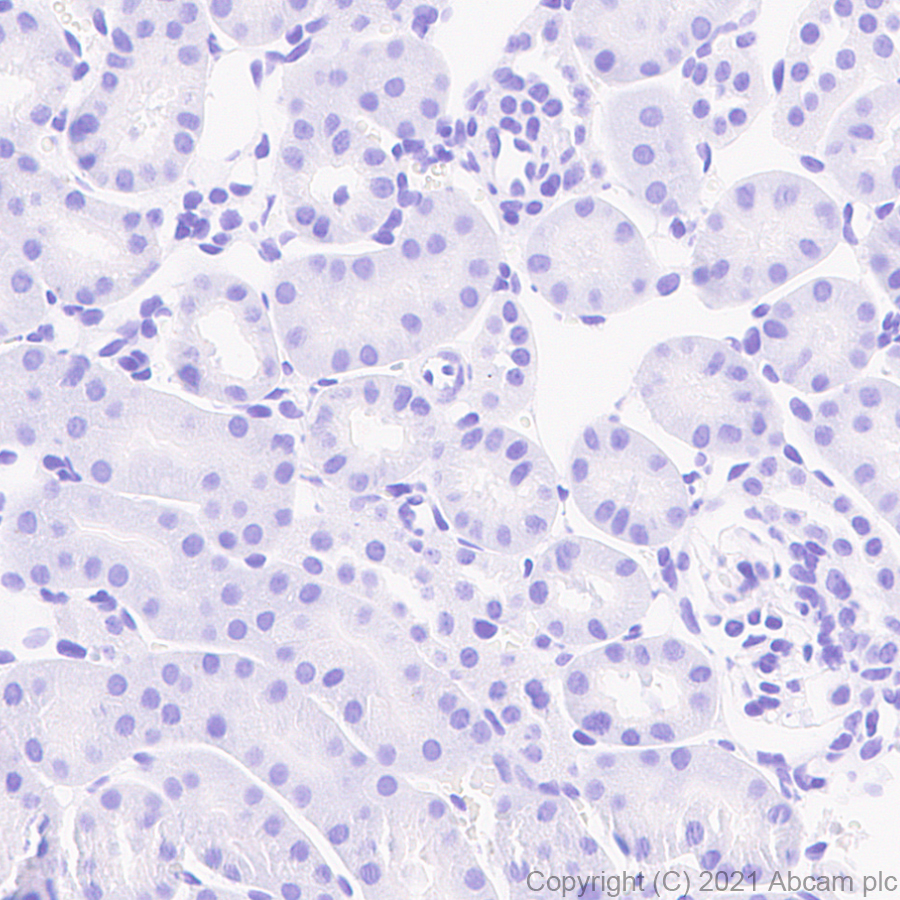 Immunohistochemistry (Formalin/PFA-fixed paraffin-embedded sections) - Anti-Caveolin-3 antibody [RM1042] (ab289544), expandable thumbnail
