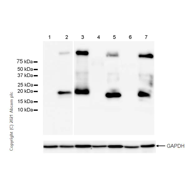 Western blot - Anti-Caveolin-3 antibody [RM1042] - Caveolae Marker (AB289544)
