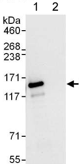 Immunoprecipitation - Anti-CBF antibody (AB176579), expandable thumbnail