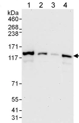 Western blot - Anti-CBF antibody (AB176579)