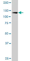 Western blot - Anti-CBF antibody (AB89034)
