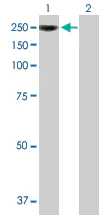 Western blot - Anti-CBF antibody (AB89034)