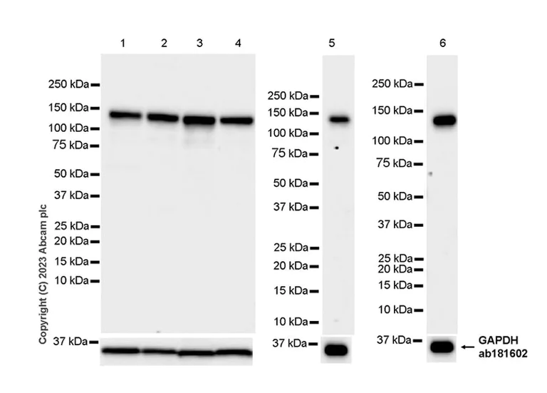 Western blot - Anti-CBF antibody [EPR27441-85] (AB314319)