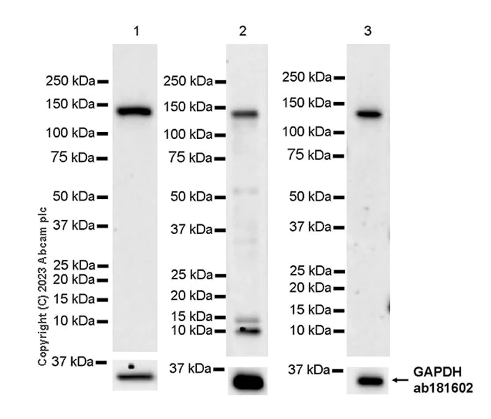 Western blot - Anti-CBF antibody [EPR27441-85] - BSA and Azide free (AB314320)