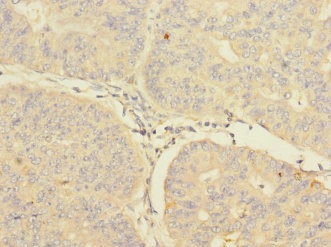 Immunohistochemistry (Formalin/PFA-fixed paraffin-embedded sections) - Anti-CBF1 interacting corepressor/CIR1 antibody - N-terminal (AB229866)